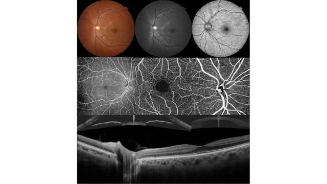 Multimodal imaging example