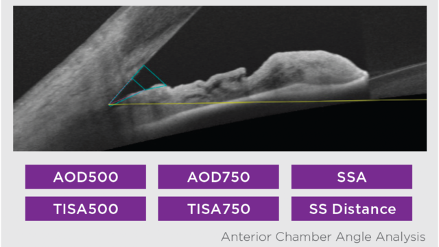 Anterior Segment Imaging