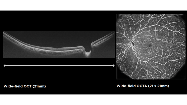 Wide-field OCT and OCTA