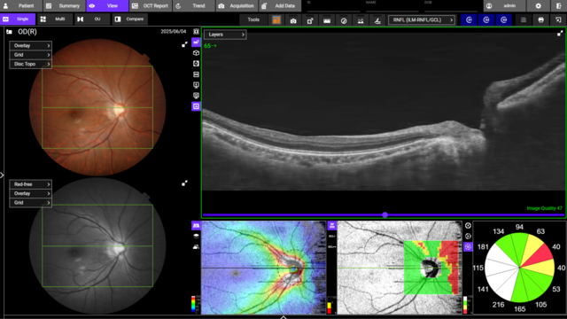 3D Wide-Scan