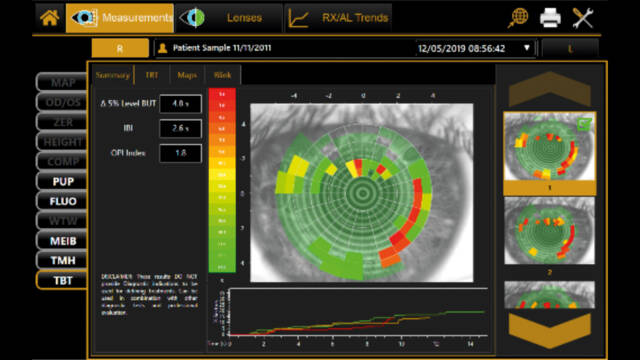 dry eye assement tool