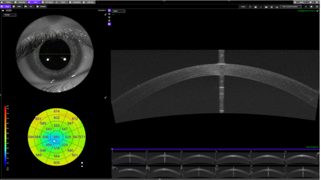 Radial Line Scan