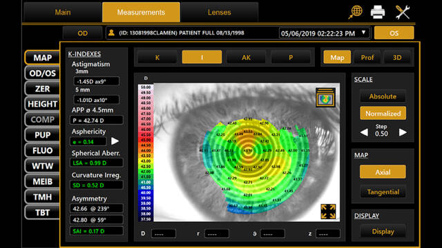 corneal mapping