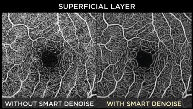 Smart Denoise
